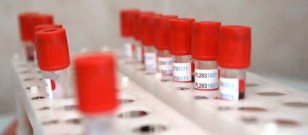 Епрувете за анализу крви добровољаца за испитивање вакцине против вируса корона Епрувете за анализу крви добровољаца за испитивање вакцине против вируса корона - Sputnik Србија