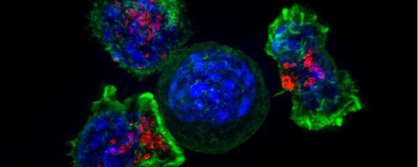 T ćelije napadaju ćeliju raka - Sputnik Srbija