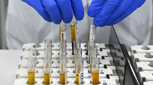 Laborant u laboratoriji Hemotest tokom procene efikasnosti vakcine protiv kovida Sputnjik V - Sputnik Srbija