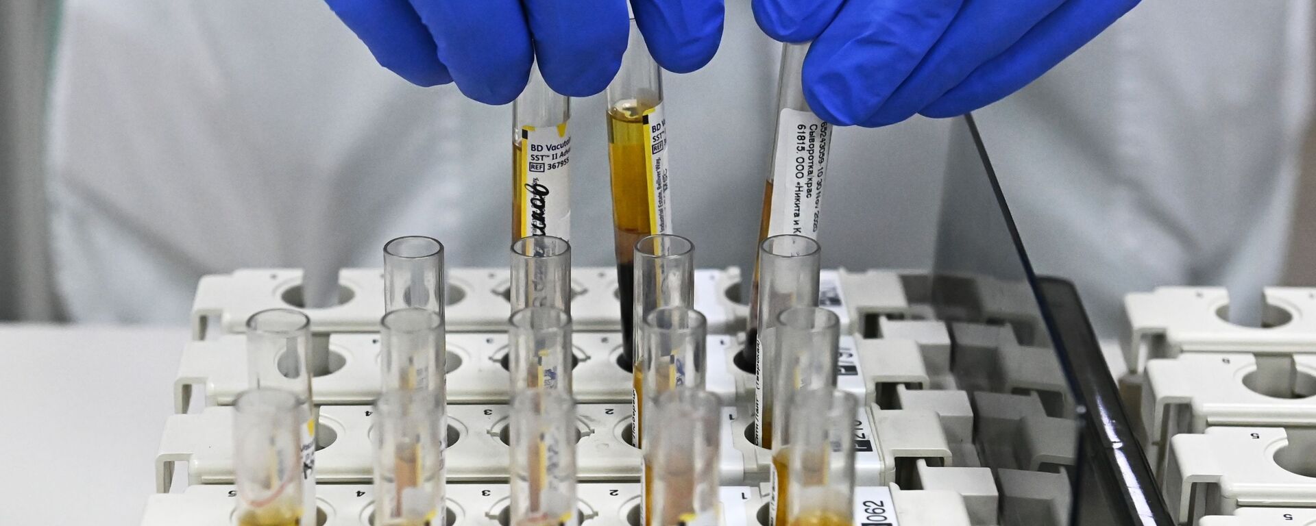 Laborant u laboratoriji Hemotest tokom procene efikasnosti vakcine protiv kovida Sputnjik V - Sputnik Srbija, 1920, 01.03.2023