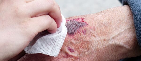 Рана - Sputnik Србија