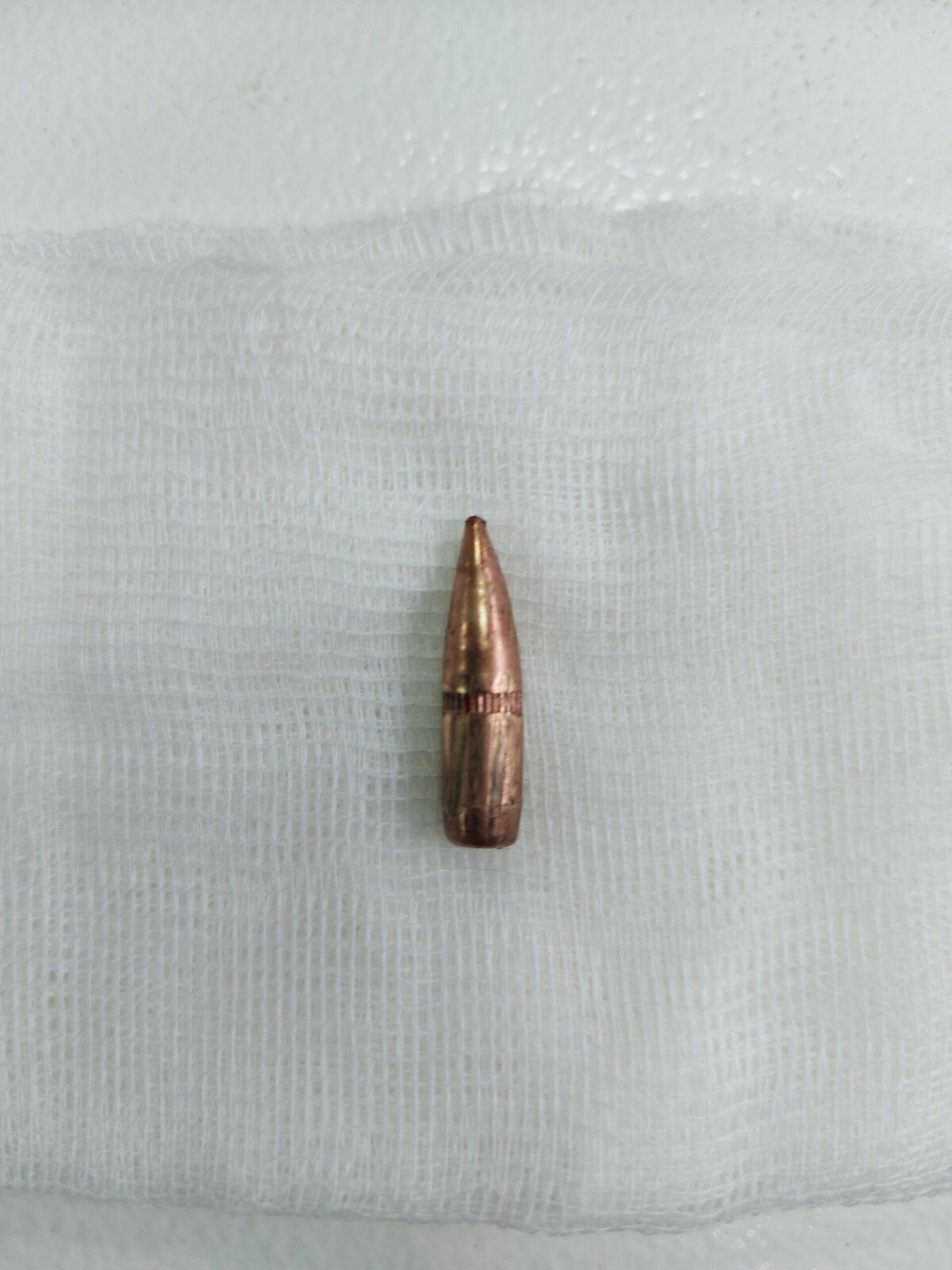 Metak koji je izvađen iz tela Srbina koji je ranjen u Zvečanu - Sputnik Srbija, 1920, 13.10.2021