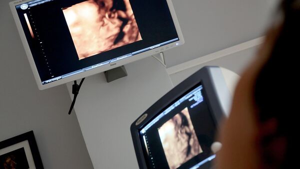 Ultrazvučni pregled u trudnoći - Sputnik Srbija