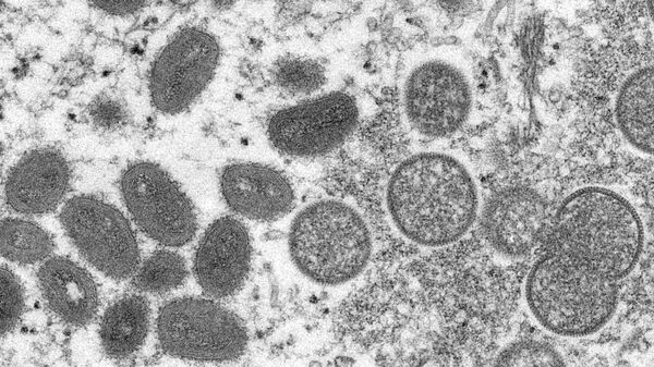 Virus pod mikroskopom, arhivska fotografija - Sputnik Srbija