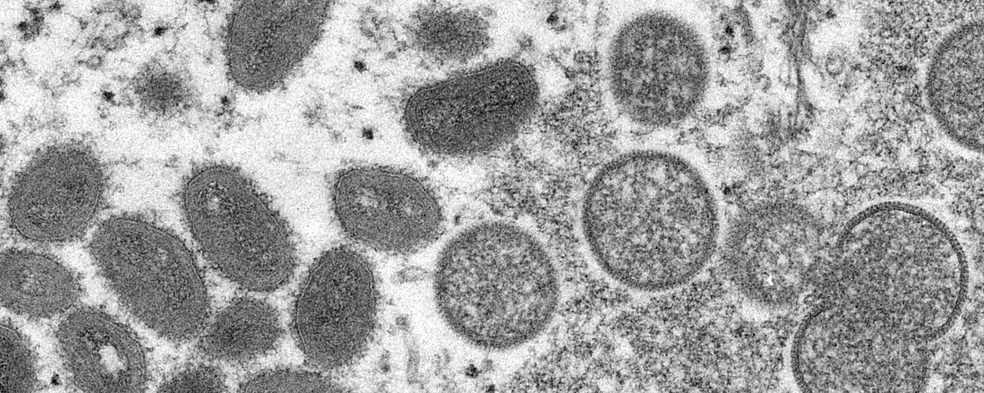 Virus majmunskih boginja pod mikroskopom - Sputnik Srbija, 1920, 04.06.2022