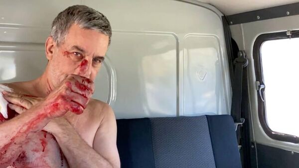 Венецуелански новинар који је рањен у Донбасу - Sputnik Србија
