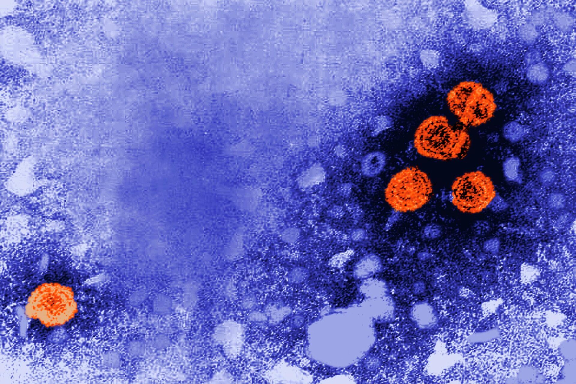 Фотографија електронског микроскопа приказује честице вируса хепатитиса Б, означене наранџастом бојом - Sputnik Србија, 1920, 18.11.2022