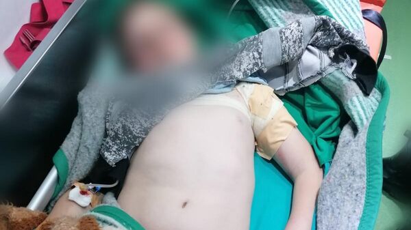 Дечаци рањени у Штрпцу на Бадњи дан - Sputnik Србија