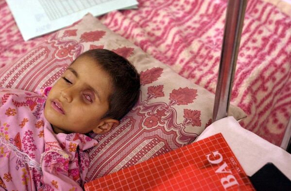 Четворогодишња Ала Салем, која пати од тумора на оку, лежи на кревету док чека лекове 15. јануара 2001. године у дечјој болници у граду Басра на југу Ирака. Ирачке власти тврде да су савезничке снаге током бомбардовања у Заливском рату користиле око 300 тона бомби са осиромашеним уранијумом, што је одговорно за пораст оболевања од рака у тој области. - Sputnik Србија