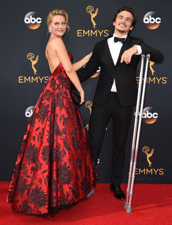 Ejmi Malins je američka glumica i model. Zbog urođene hemimelije, sa godinu dana su joj amputirane obe noge. - Sputnik Srbija