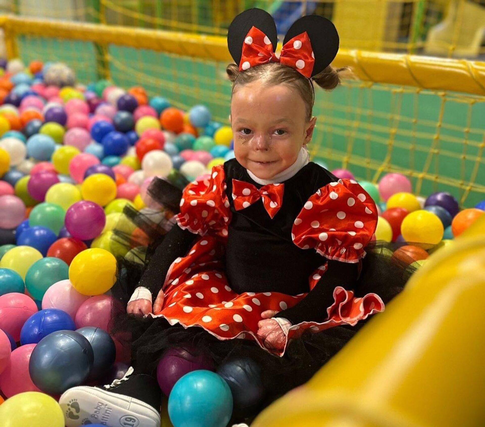 Нађа Марковић из Чачка терапију прима последњих шест месеци - Sputnik Србија, 1920, 01.10.2025