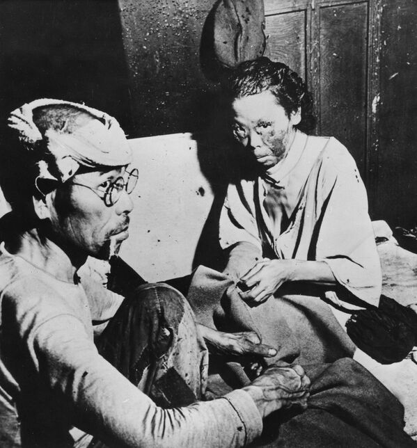 Жртве у Хирошими, убрзо након прве експлозије атомске бомбе на крају Другог светског рата, 6. августа 1945. - Sputnik Србија