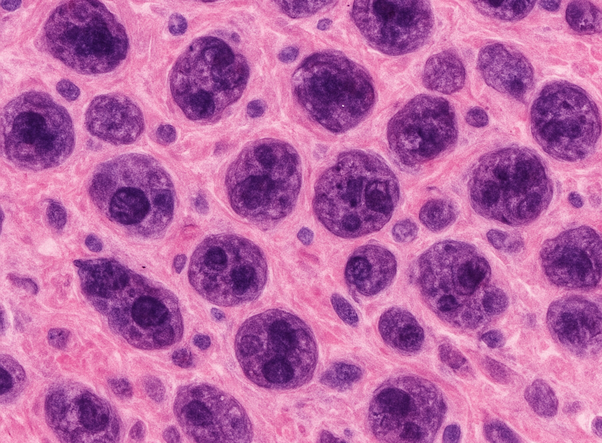 Ćelije melanoma pod mikroskopom - Sputnik Srbija, 1920, 02.10.2025