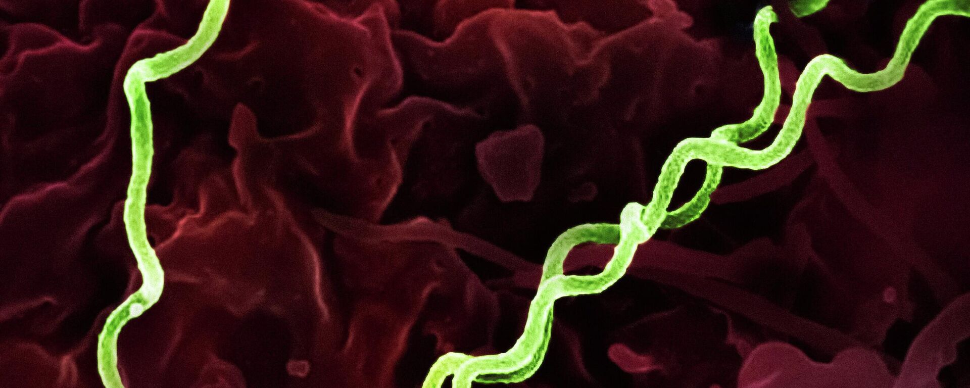 Бактерија „Трепонема палидум“ - Sputnik Србија, 1920, 27.01.2026