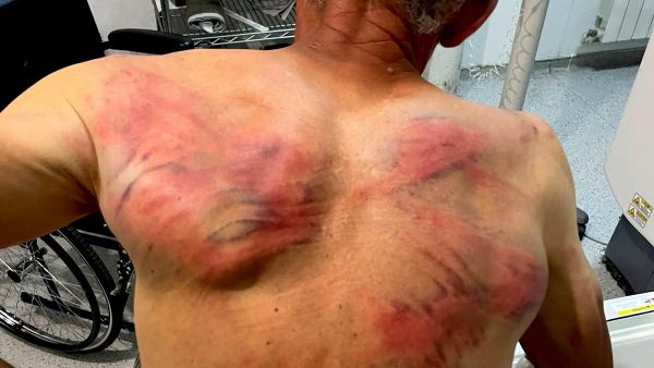 Повреде на телу Ненада Рашковића - Sputnik Србија