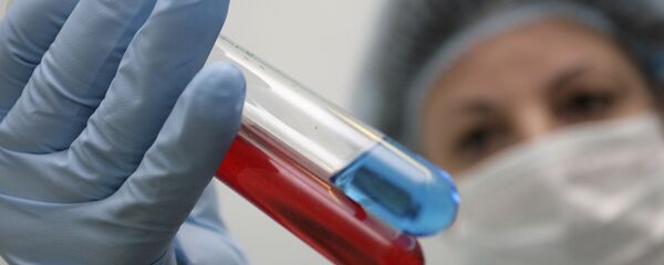 У лабораторији за истраживање вируса Центра за превенцију и борбу против сиде и заразних болести спроводе се истраживања крви животиња и људи на присуство вируса свињског и птичјег грипа. У лабораторији за истраживање вируса Центра за превенцију и борбу против сиде и заразних болести спроводе се истраживања крви животиња и људи на присуство вируса свињског и птичјег грипа. - Sputnik Србија