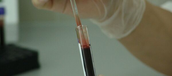 Увоз крвне плазме отвара и питање безбедности - Sputnik Србија
