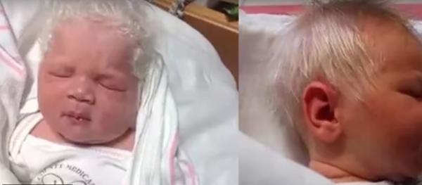 Беба рођена с белом косом - Sputnik Србија