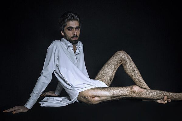 „Жртва шверцера“ – фотографија Седеха Сурија из Ирана. Двадесетогодишњи Бехруз који је упуцан за време шверца горива из Ирана у Пакистан. - Sputnik Србија