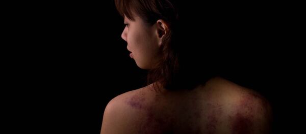 Nasilje nad ženama - Sputnik Srbija