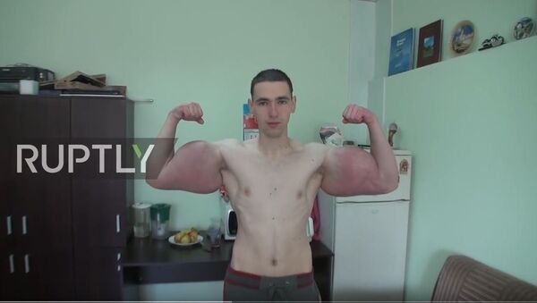Kiril Terešin iz Pjatigorska, Rusija, pokazuje bicepse posle ubrizgavanja „Sintola“. - Sputnik Srbija