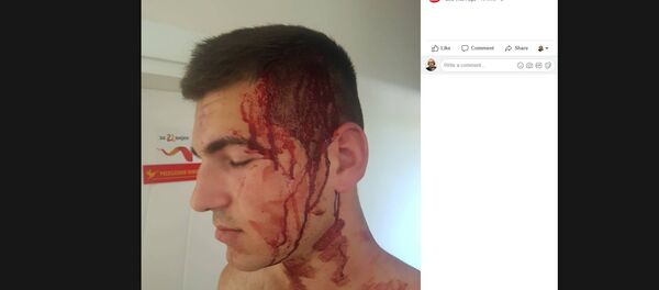 Нападнути активиста коалиције Подгорица за 21. вијек - Sputnik Србија