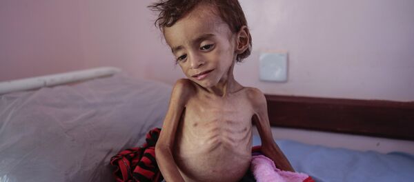 Изгладнело дете из Јемена - Sputnik Србија