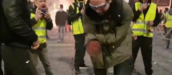 Крвав снимак с демонстрација у Бордоу - Sputnik Србија