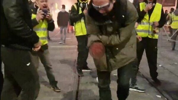 Крвав снимак с демонстрација у Бордоу - Sputnik Србија