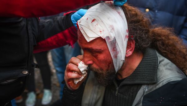 Дописник Спутњика у Грчкој, фотограф Костис Дадамис након рањавања на протестима у Атини - Sputnik Србија