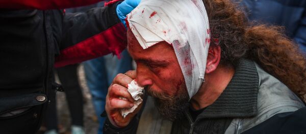 Дописник Спутњика у Грчкој, фотограф Костис Дадамис након рањавања на протестима у Атини - Sputnik Србија