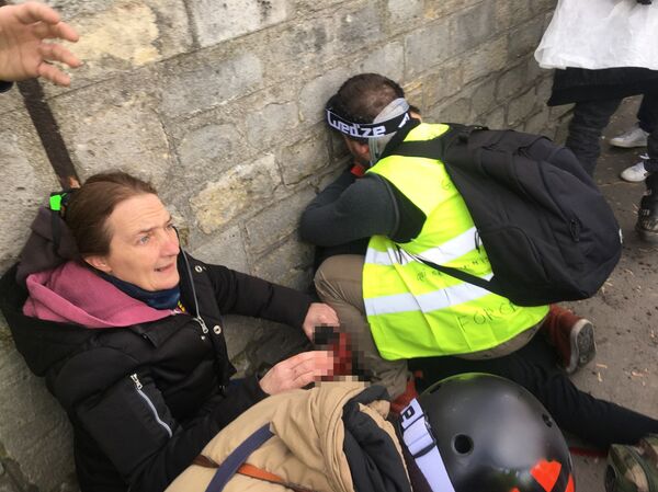 Граната откинула део руке демонстранту „Жутих прслука Граната откинула део руке демонстранту „Жутих прслука - Sputnik Србија