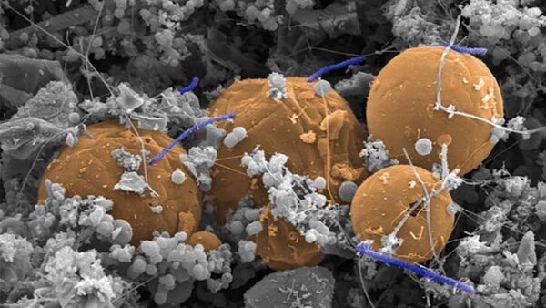 Candidatus Desulforudis audaxviator  (ljubičasta bakterija koja nanosi narančaste ugljene lopte) ispod rudnika zlata Mponeng u Južnoj Africi - Sputnik Srbija