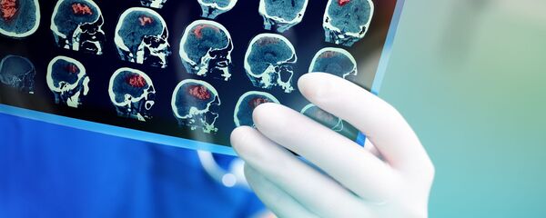 Рендгенски снимак мозга пацијента - Sputnik Србија