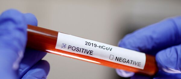 Koronavirus - Sputnik Srbija