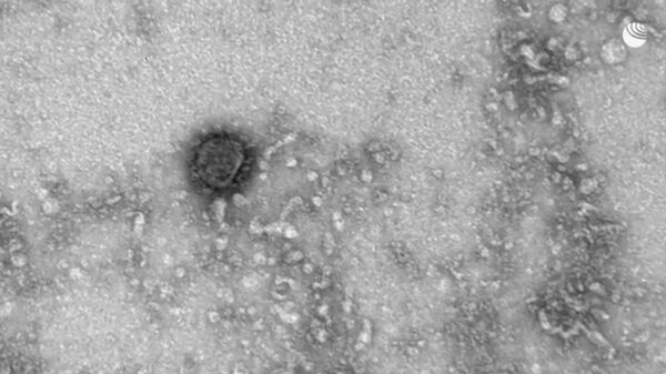 Објављен видео-снимак коронавируса под микроскопом /видео, фото/  - Sputnik Србија