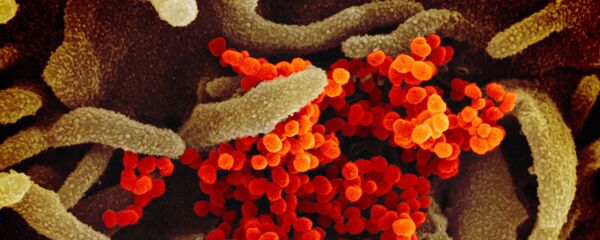 Virus korone pod mikroskopom Virus korone pod mikroskopom - Sputnik Srbija