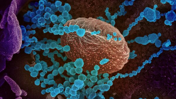 Virus korona, koji izaziva bolest kovid 19, pod elektronskim mikroskopom - Sputnik Srbija