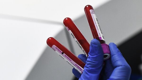 Узорци крви у лабораторији за биохемијска и имунохемијска испитивања у Новосибирску - Sputnik Србија