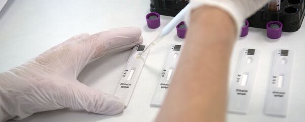 Брзо тестирање на вирус корона у лабораторији клинике Хадаса у техно-парку Сколково - Sputnik Србија