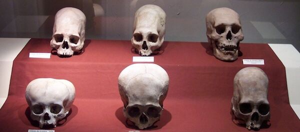 Деформисане лобање - Sputnik Србија