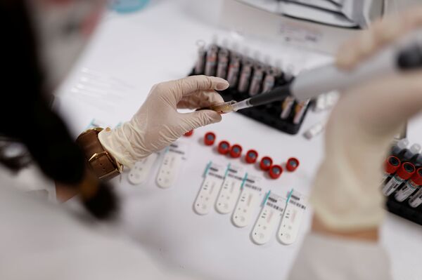 Код зубара као на операцију: Уведене строге мере, пацијенти морају под туш пре ординације  - Sputnik Србија