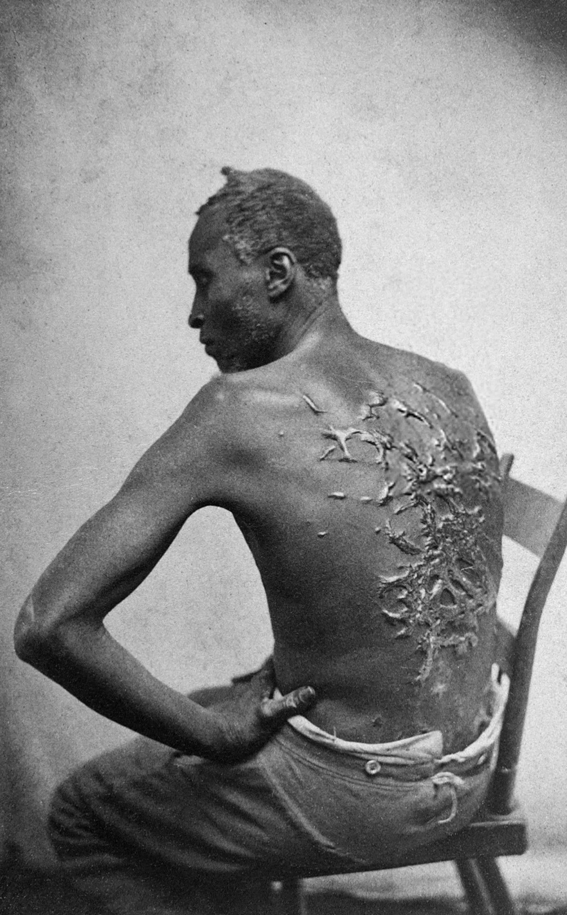 Rob iz Misisipija pokazuje ožiljke od bičevanja - Sputnik Srbija, 1920, 19.04.2024