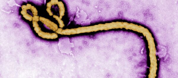 Вирус еболе - Sputnik Србија