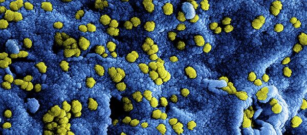 МЕРС коронавирус - Sputnik Србија